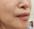 before_image