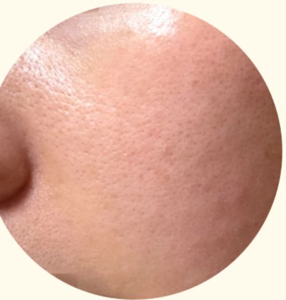before_image
