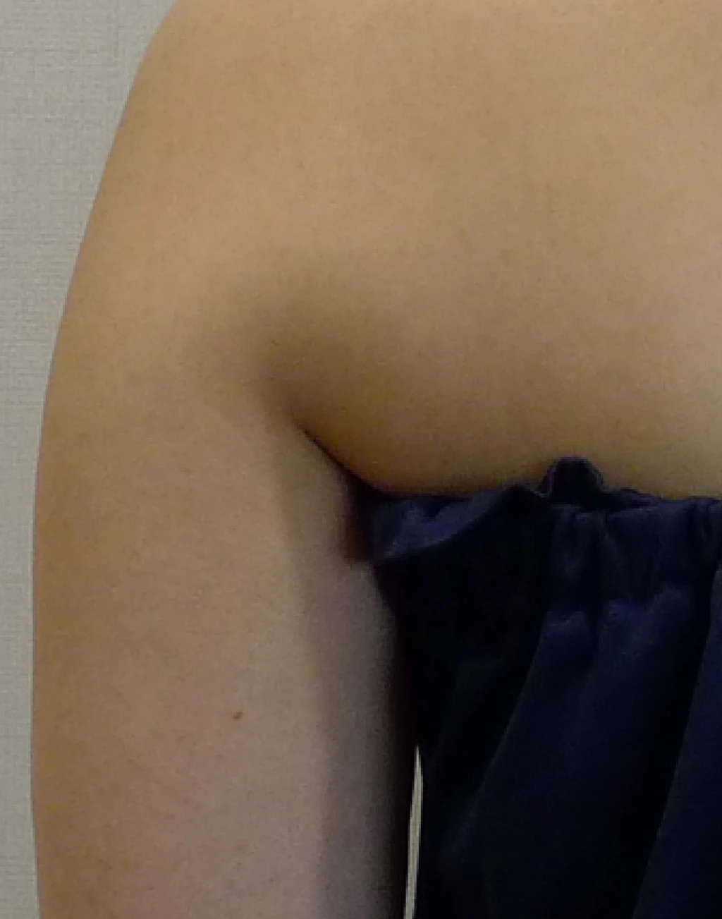 before_image