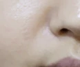 before_image