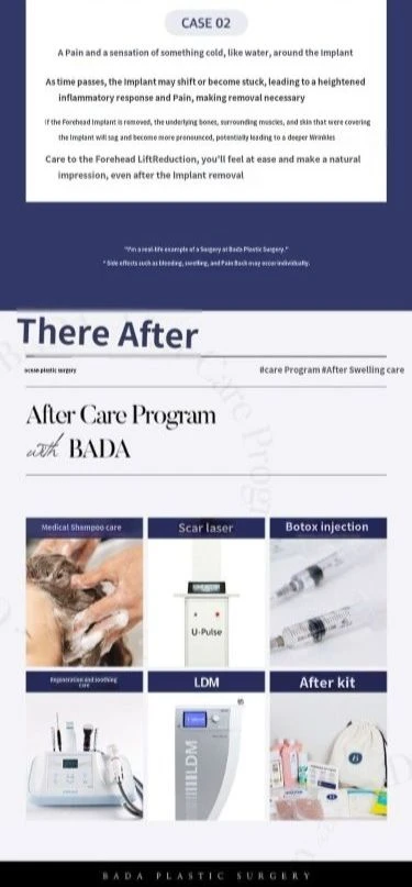treatmentIntroduction