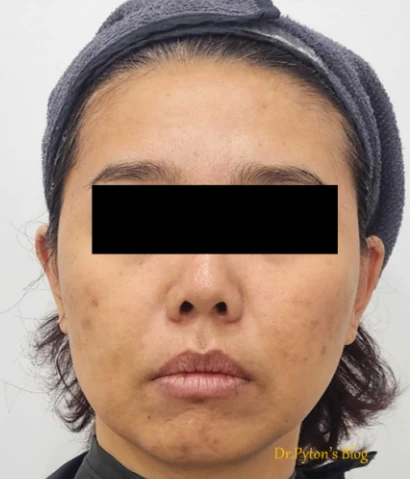 before_image