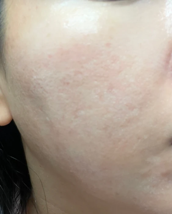 before_image