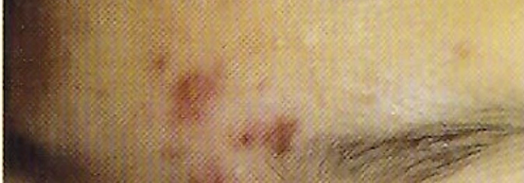before_image