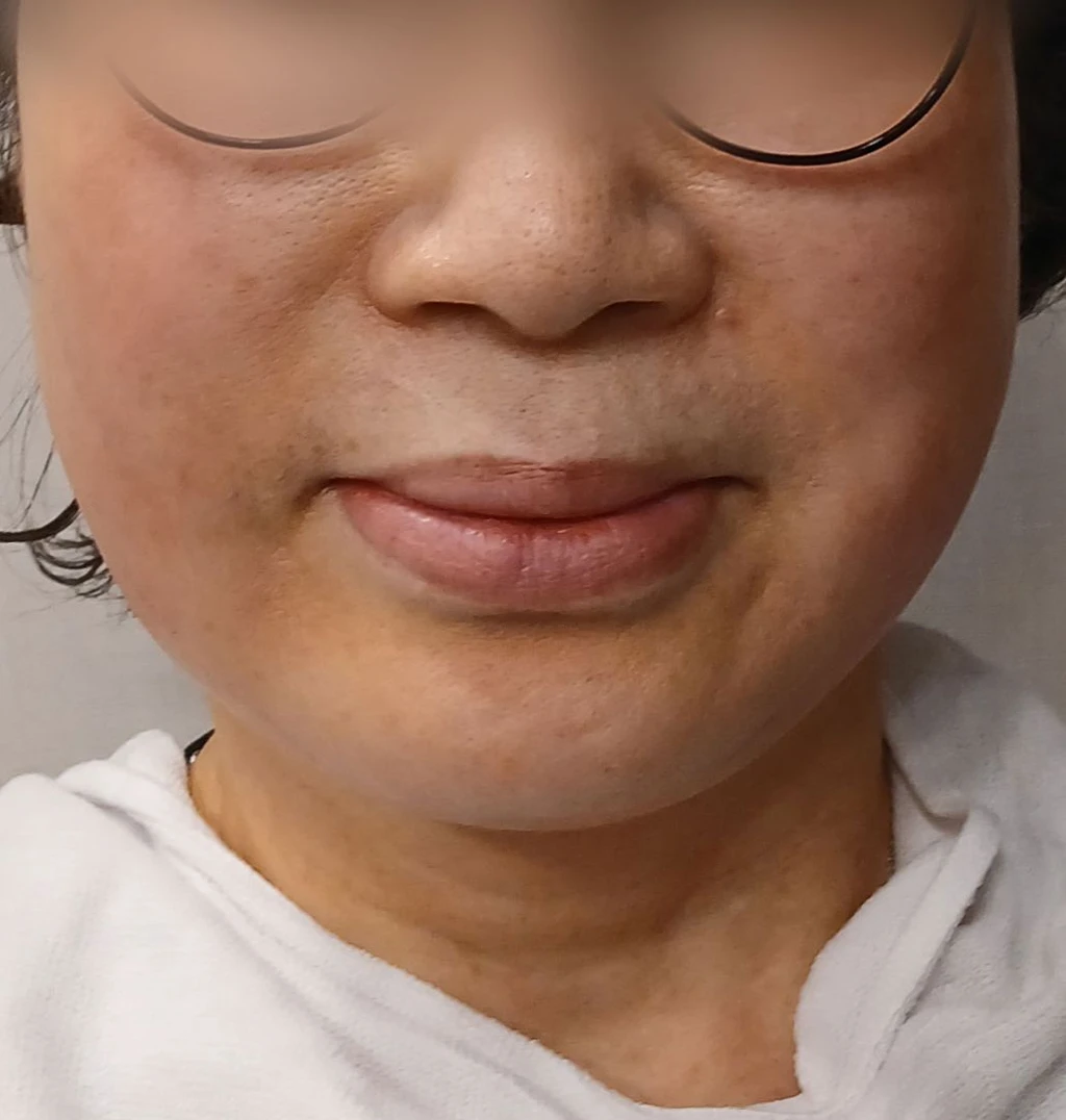 before_image