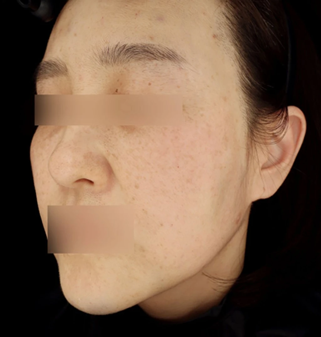 before_image