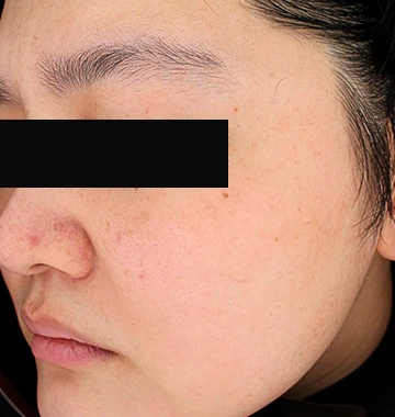 before_image