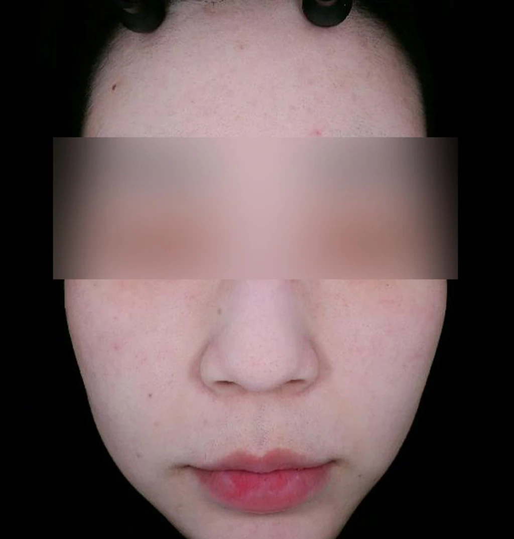 before_image