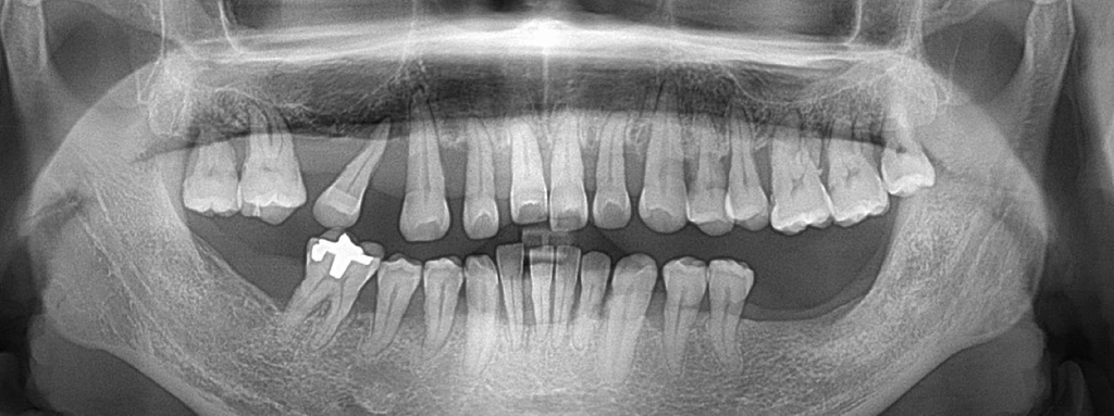before_image