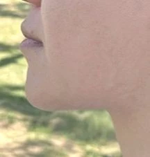 before_image