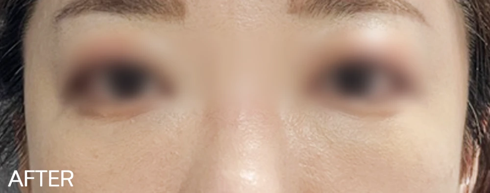 before_image