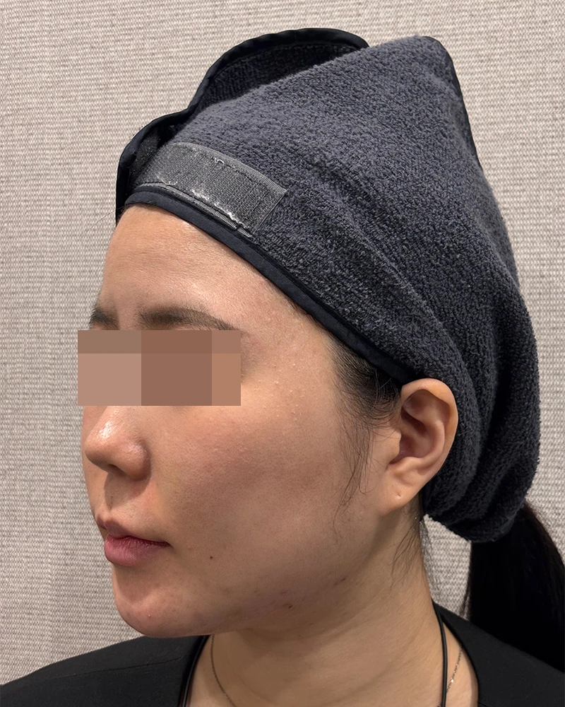 before_image