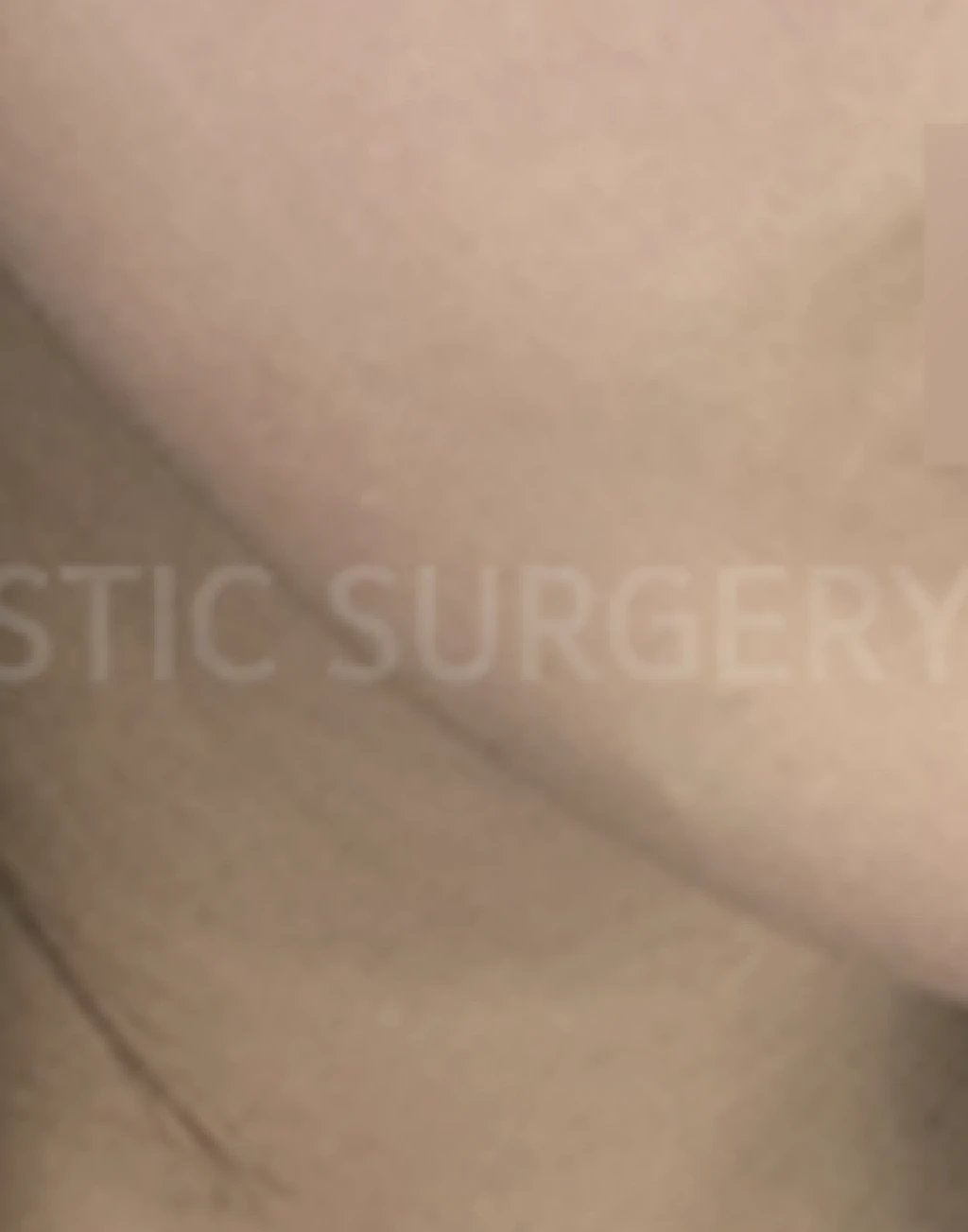 before_image