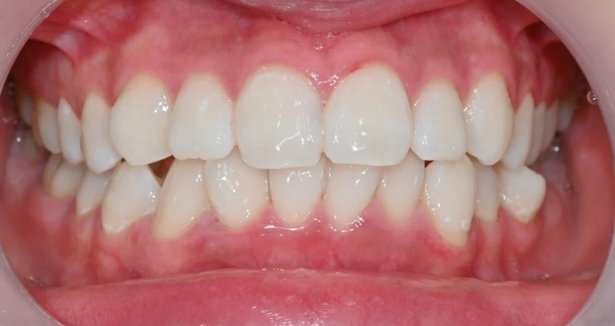 before_image