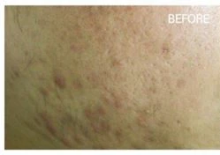 before_image