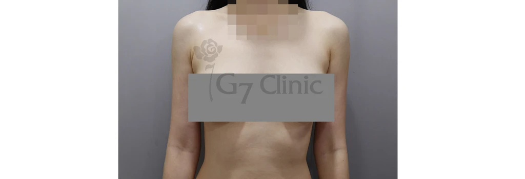 before_image