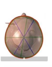before_image