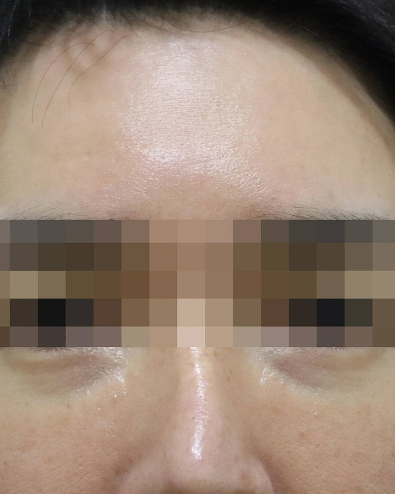 before_image