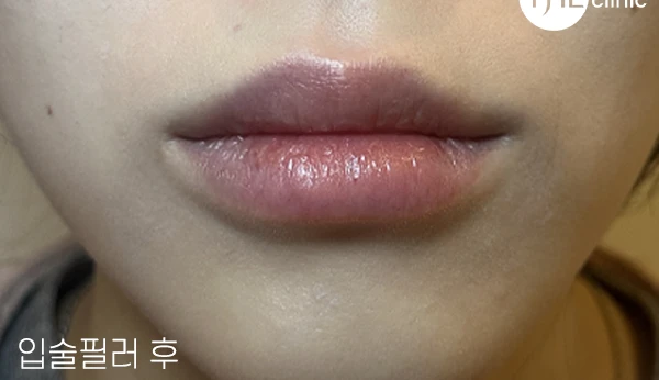 before_image