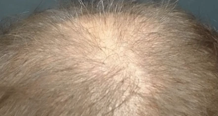 before_image