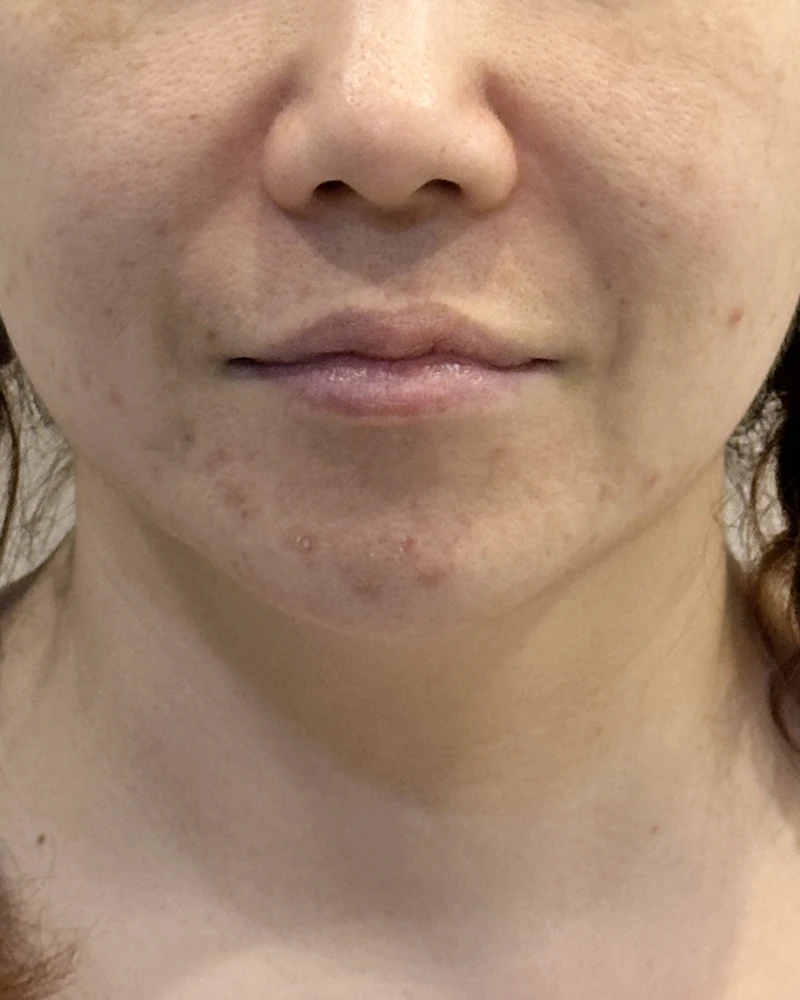 before_image