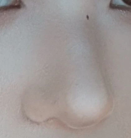 before_image