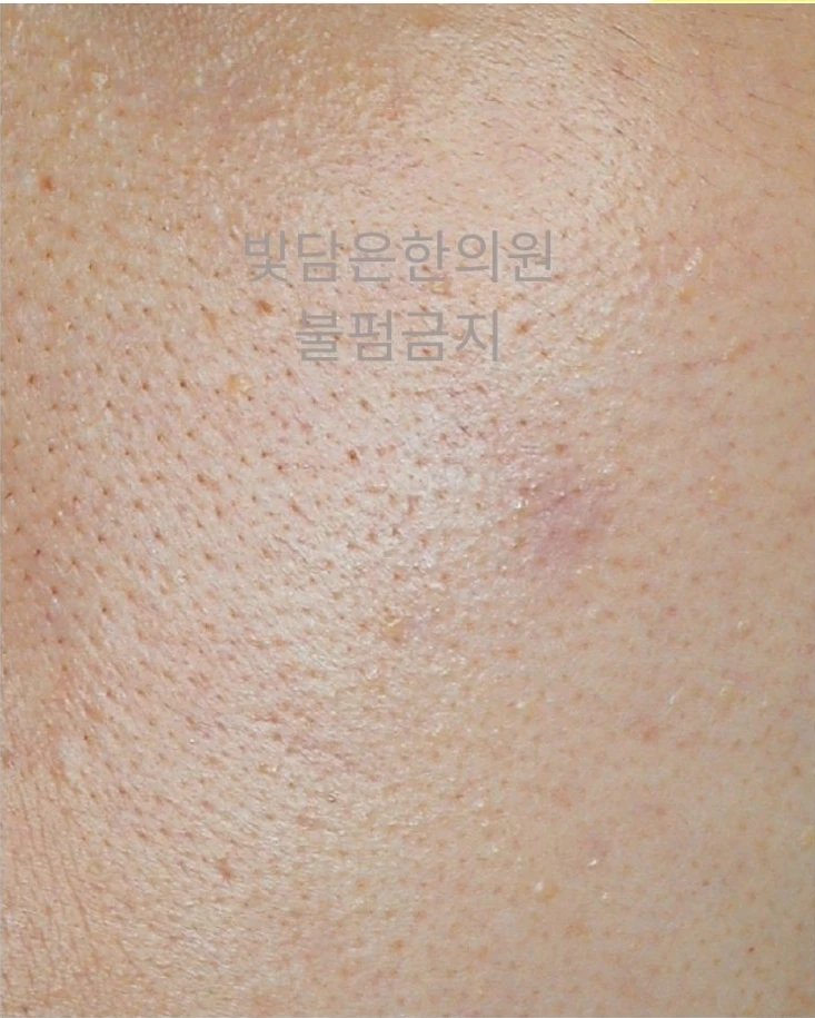 before_image