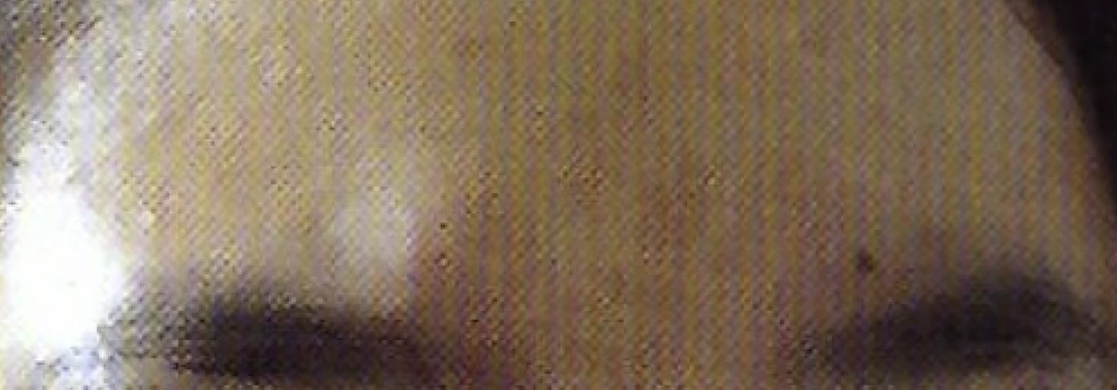before_image