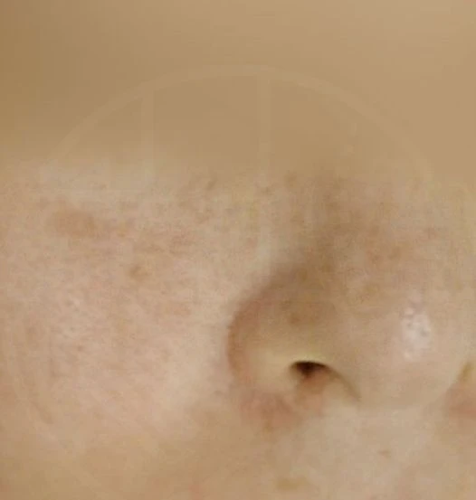 before_image
