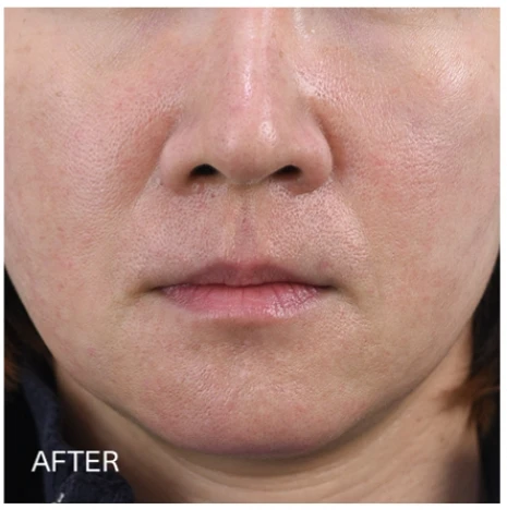 before_image