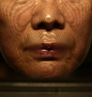 before_image
