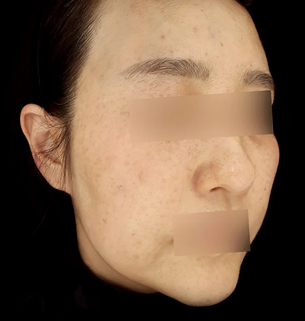 before_image