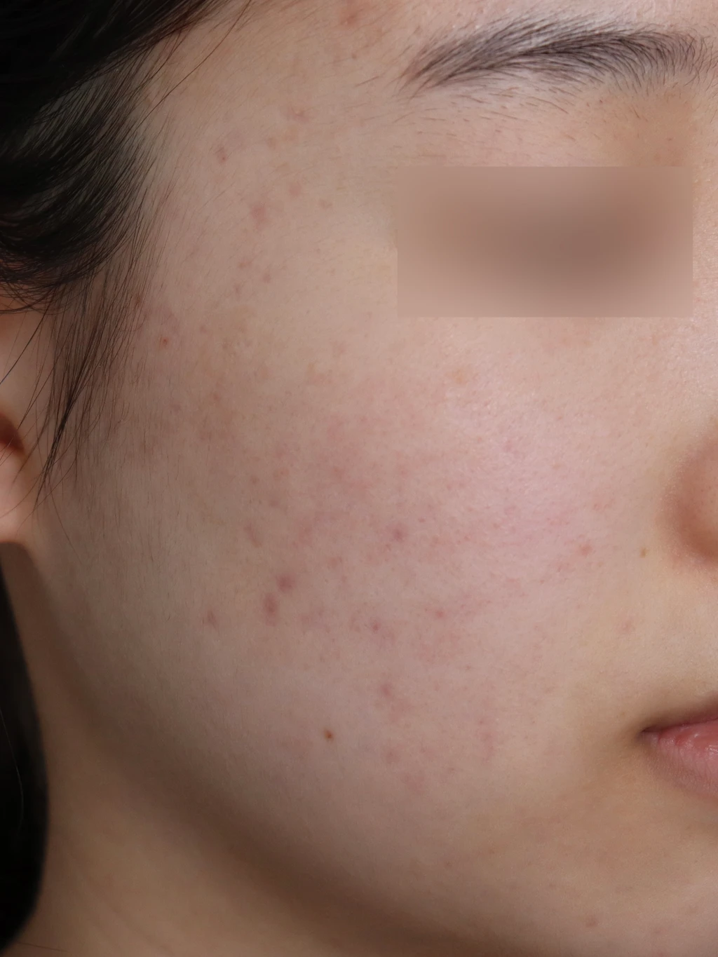 before_image