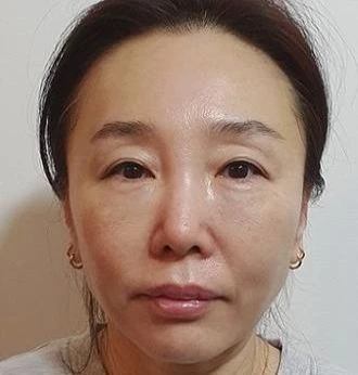 before_image