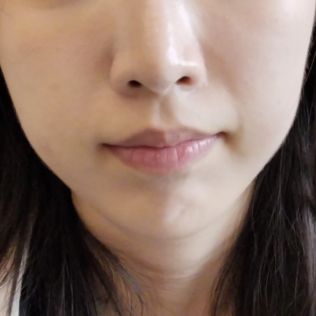 before_image