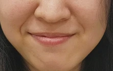 before_image