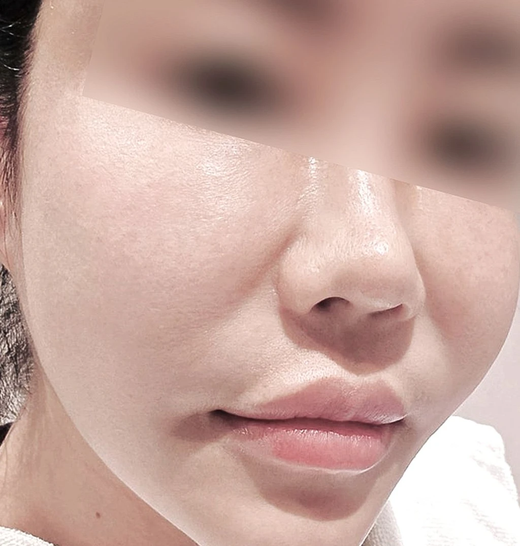 before_image