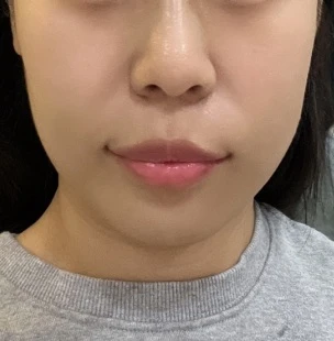 before_image