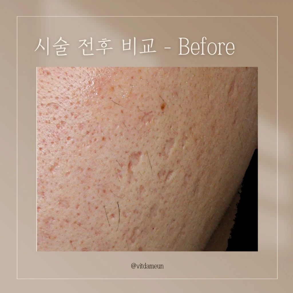 before_image