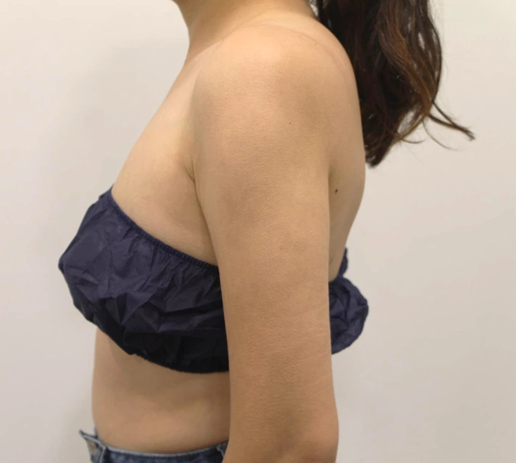 before_image