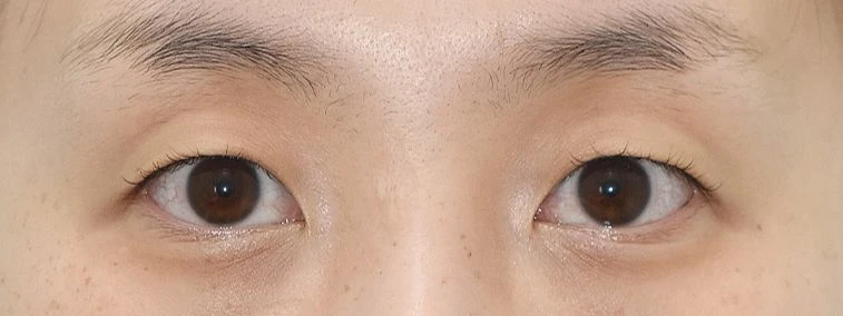 before_image