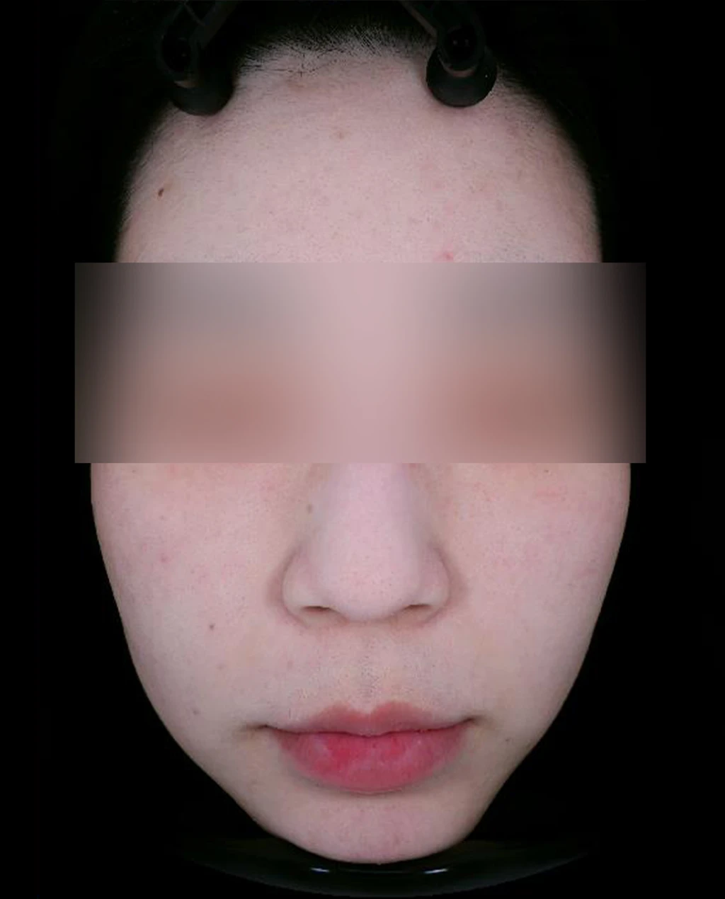 before_image