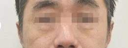 before_image