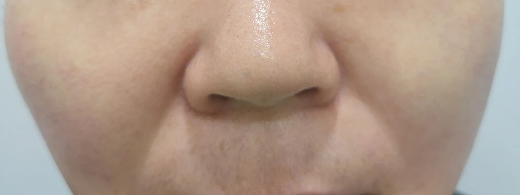 before_image
