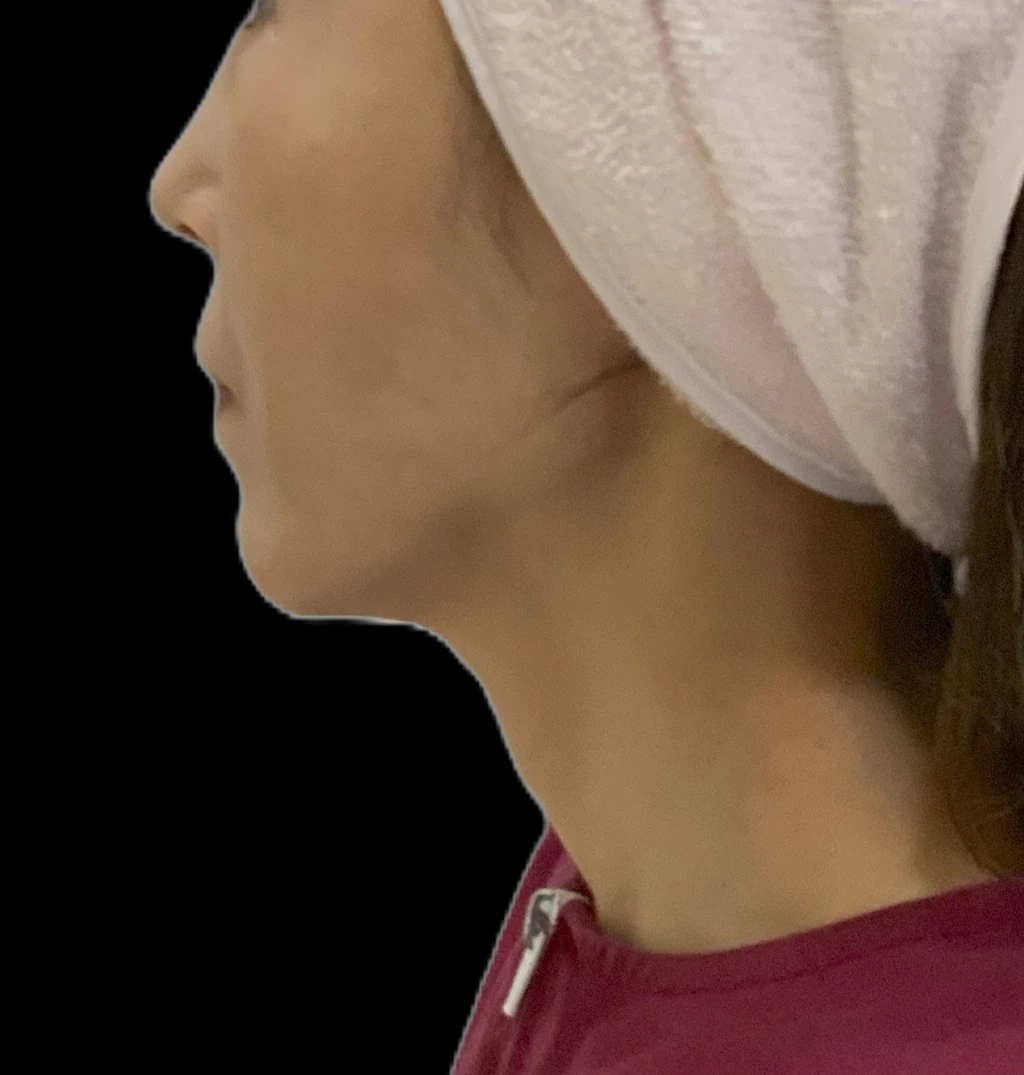 before_image