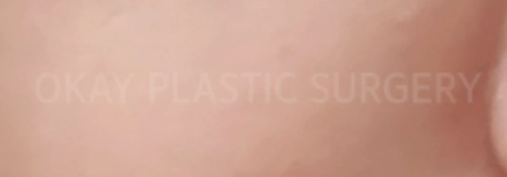 before_image