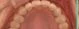 before_image