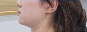 before_image