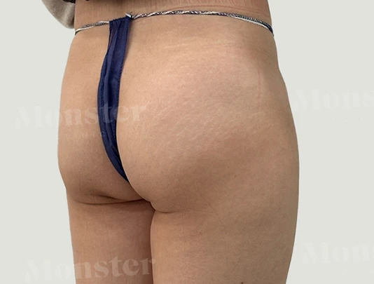 before_image