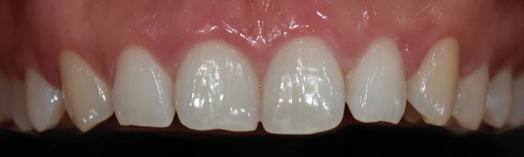 before_image